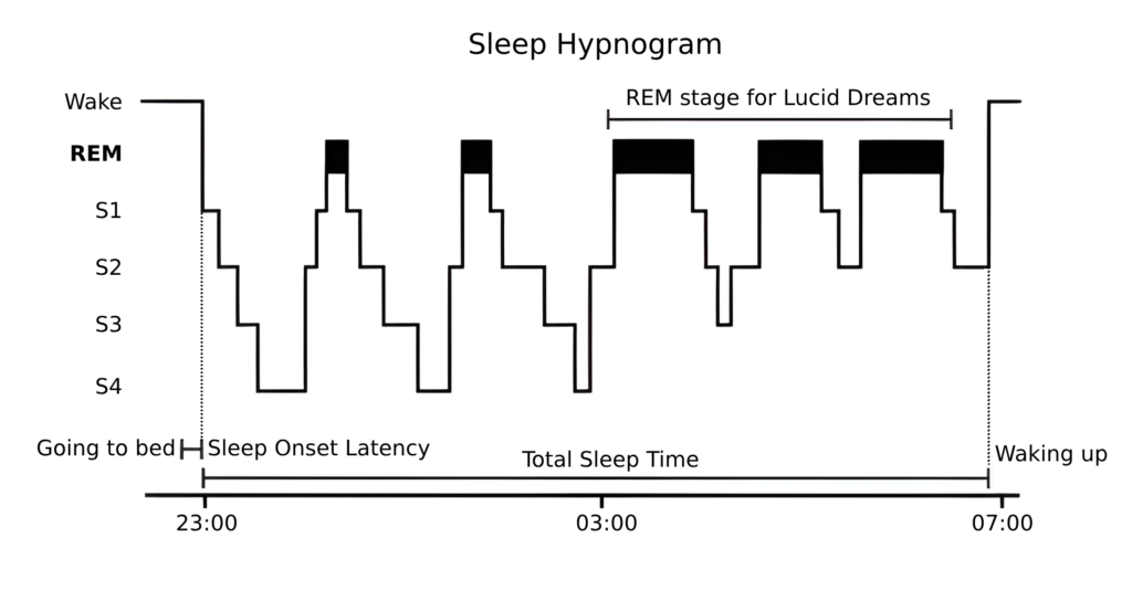 An example sleep hypnogram, depicting the ideal time for lucid dreaming